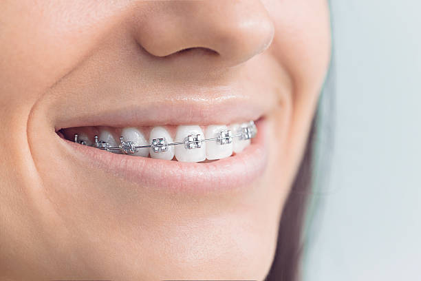 Best Wisdom Tooth Removal  in Ellport, PA